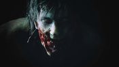 Redeem RESIDENT EVIL 2 (Xbox One) Xbox Live Key EUROPE