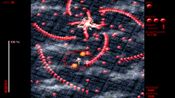 The eXceed Collection: Aural Brutality Edition Steam Key GLOBAL